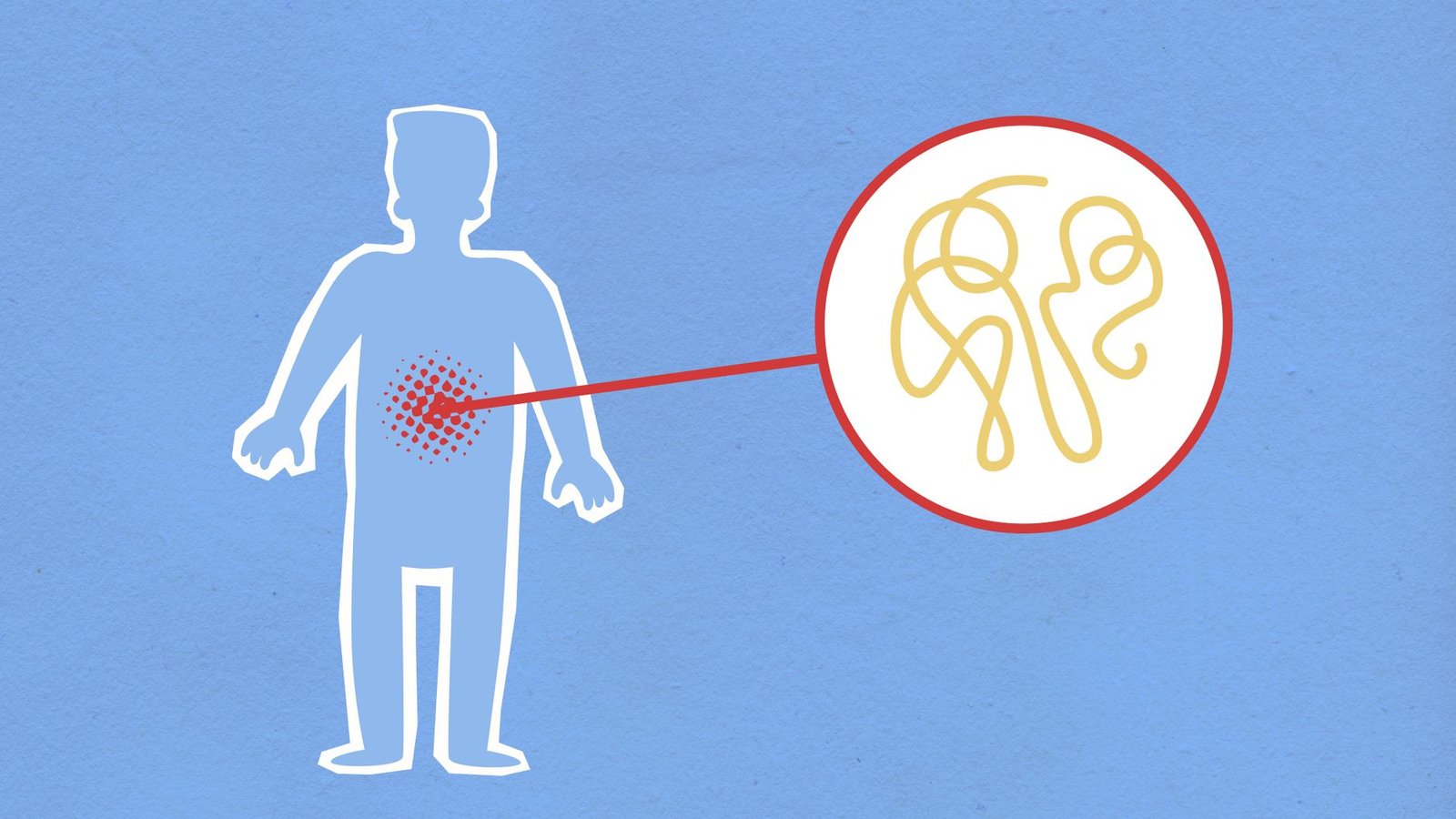 New Polymer Technology May Monitor Gastrointestinal Transit Without Ionizing Radiation